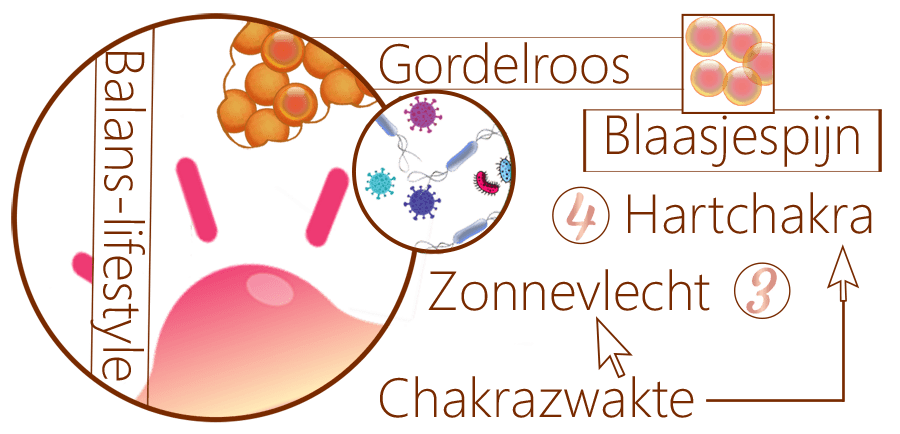 Gordelroos, blaasjespijn, herpes, waterpokkenvirus, herpesvirussen, gordelroosvirusziekte, EBV-infectie, herpesvirussen, waterpokken, huidaandoening, varicella, thymusmoeheid, hartenpijn, Eczema herpeticum, Sint-Antoniusvuur, kriebelziekte, moederkoornschimmel